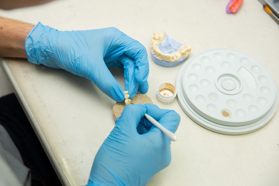 implantes dentales precio
